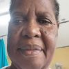 Help Edna Gayle Fight Mucosal Melanoma - a Rare and Aggressive Cancer