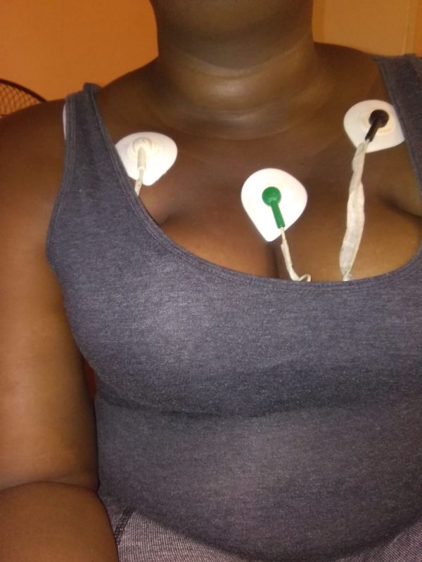 I am asking for help to do a Total Thyroidectomy - Image 3